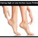 high or low Arches pain