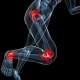 foot knee and hip+pain