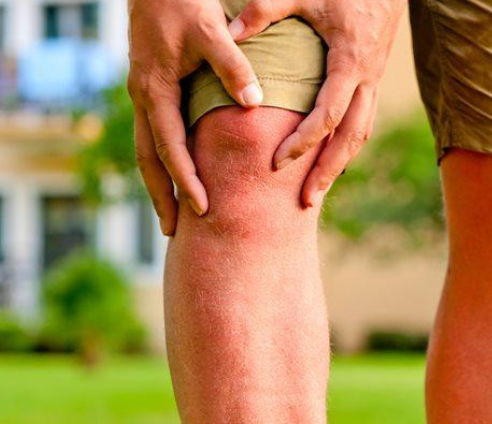Knee pain matt - What Is MME?